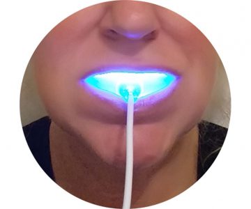 Teeth Whitening Light